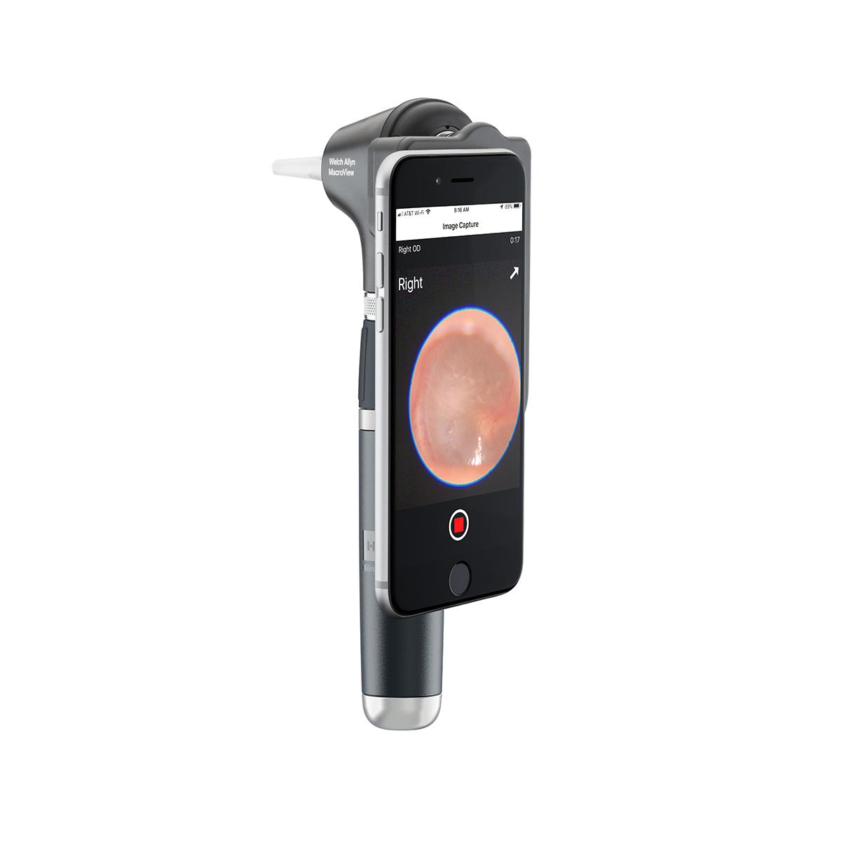Otoscope WELCH ALLYN MacroView 2 Plus iExaminer – Image 5