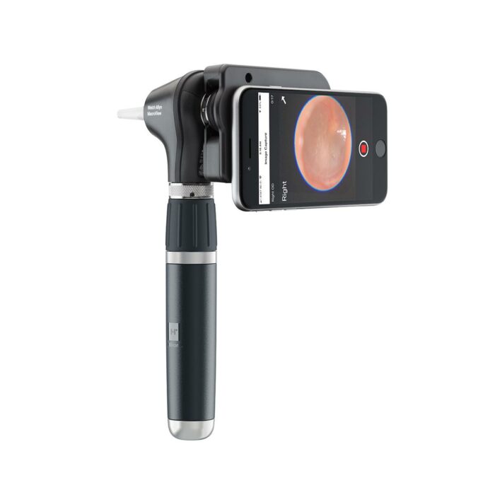 Otoscope WELCH ALLYN MacroView 2 Plus iExaminer – Image 4
