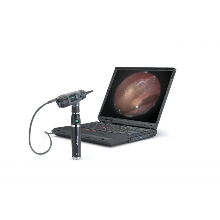 Otoscope WELCH ALLYN Macroview LED fibre optique / rechargeable – Image 4