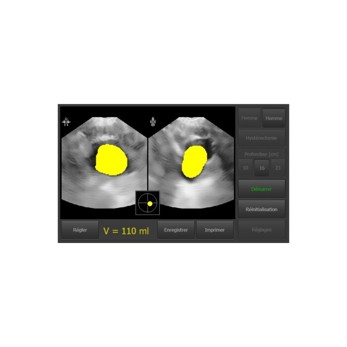 BLADDER SCANNER VITASCAN USB AVEC LOGICIEL SANS TABLETTE – Image 6