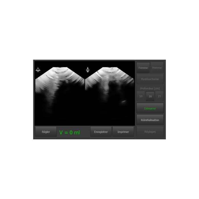 BLADDER SCANNER VITASCAN USB AVEC LOGICIEL SANS TABLETTE – Image 4