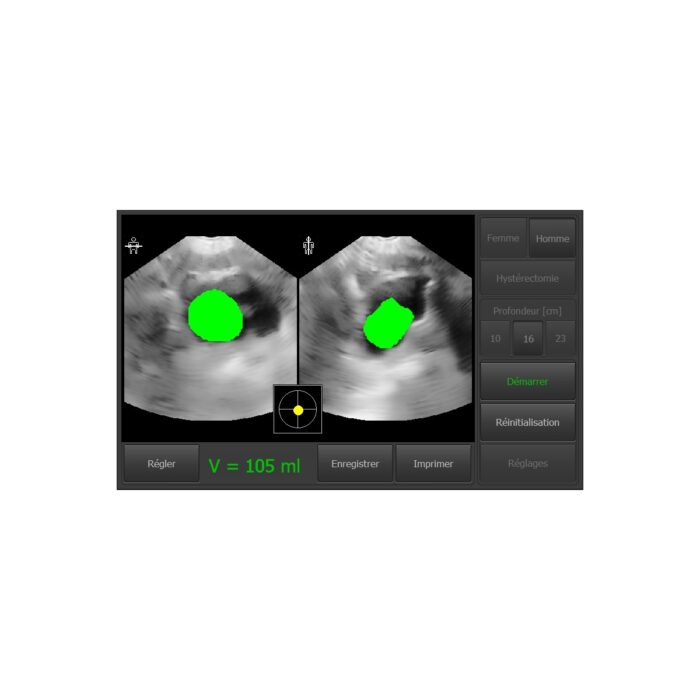 BLADDER SCANNER VITASCAN USB AVEC LOGICIEL SANS TABLETTE – Image 5