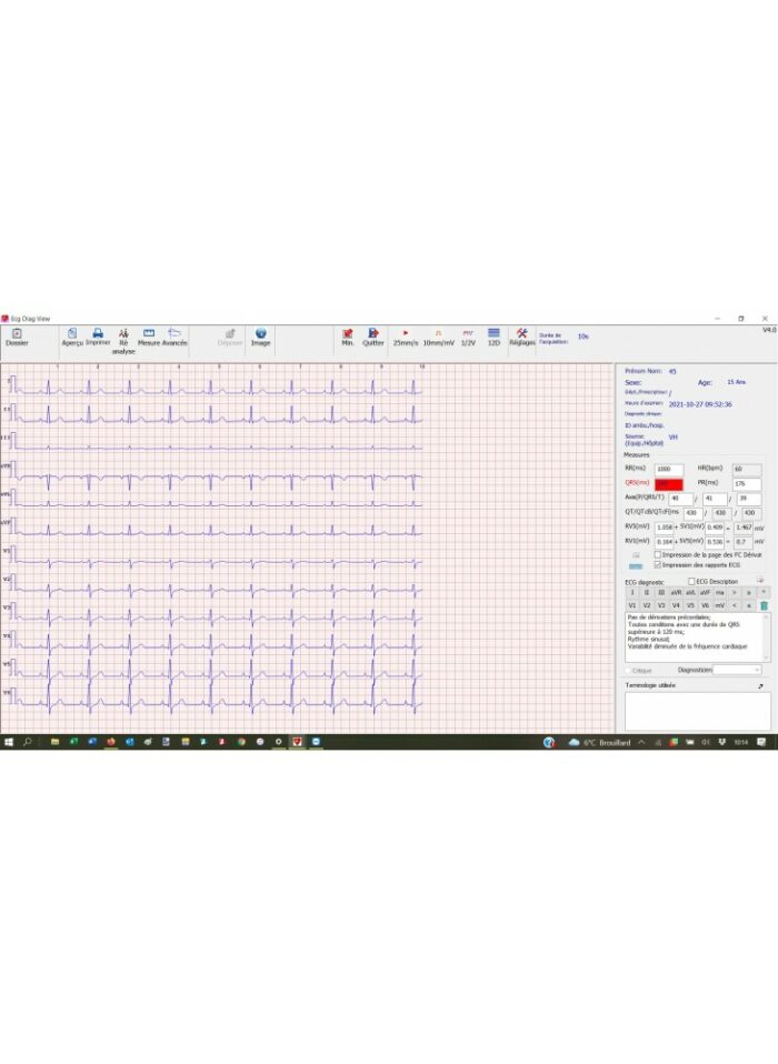 ECG NUMERIQUE APPLE – Image 3