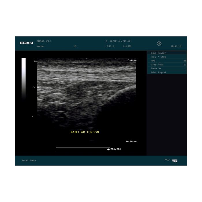 Echographe EDAN portable DUS60 – Image 4