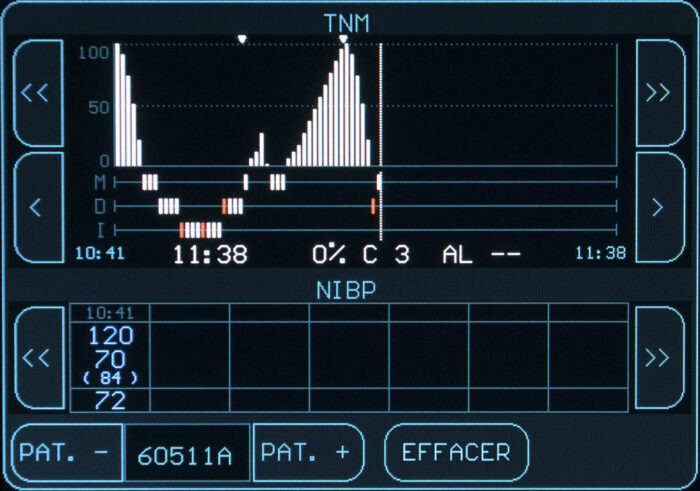 Moniteur curarisation Tof Cuff – Image 2
